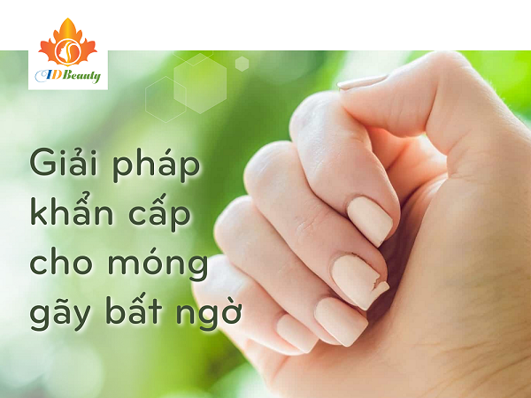 Cứu nguy cho bộ móng gãy bất ngờ